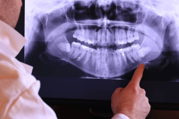 Best Urgent Dental Care for Toothache in Live Oak, TX