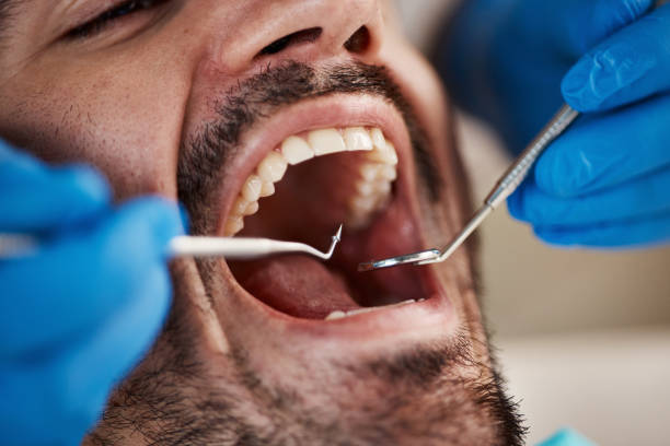 Best Emergency Dental Care for Abscessed Tooth in Live Oak, TX