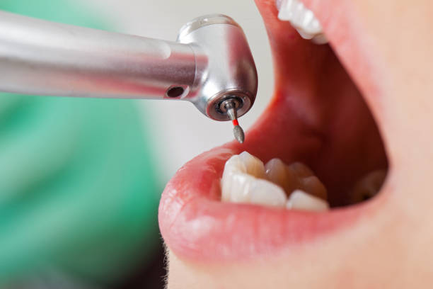 Best Broken or Cracked Tooth Emergency Dentist in Live Oak, TX